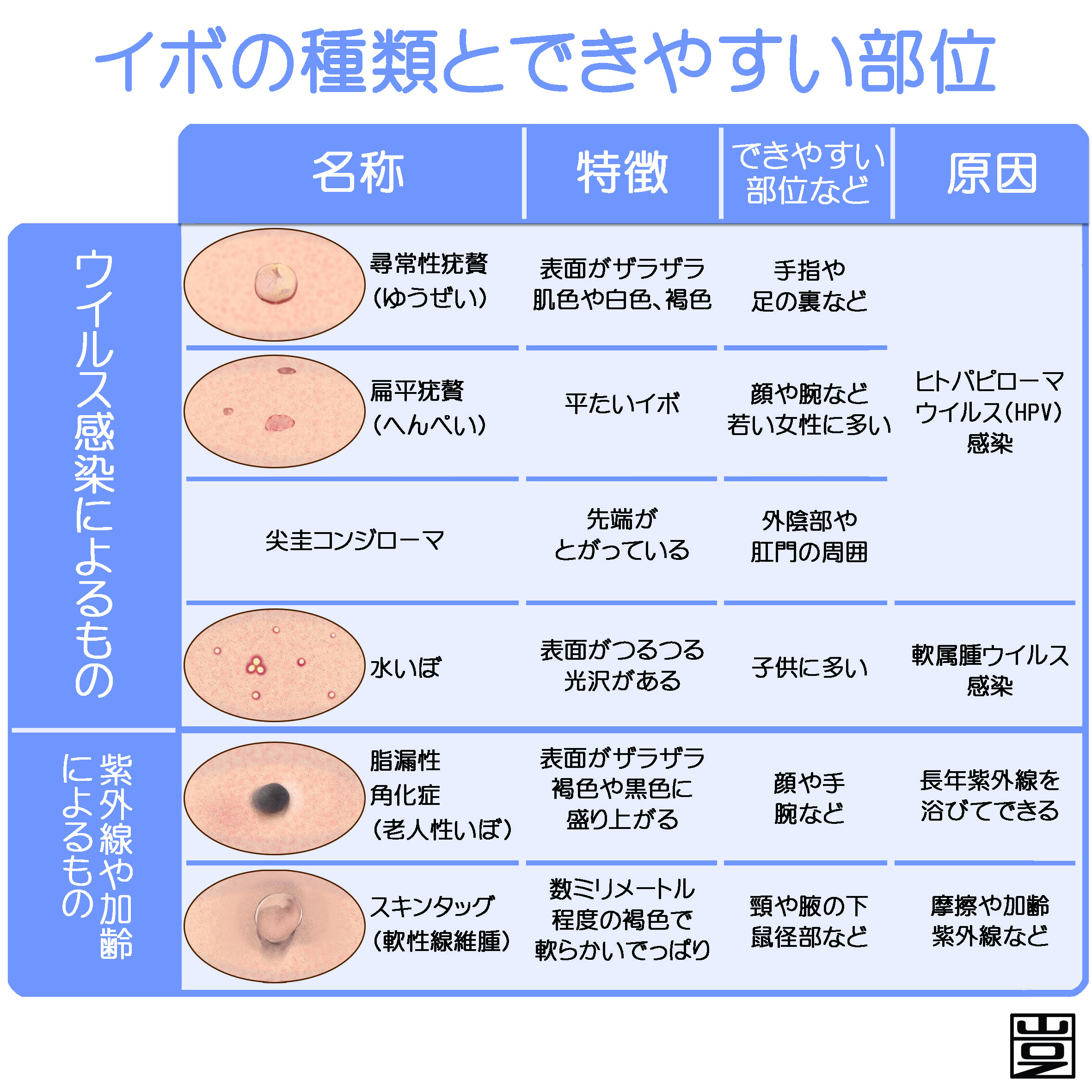 ウイルス性イボ 尋常性疣贅 とは 治療など 新宿駅前クリニック皮膚科